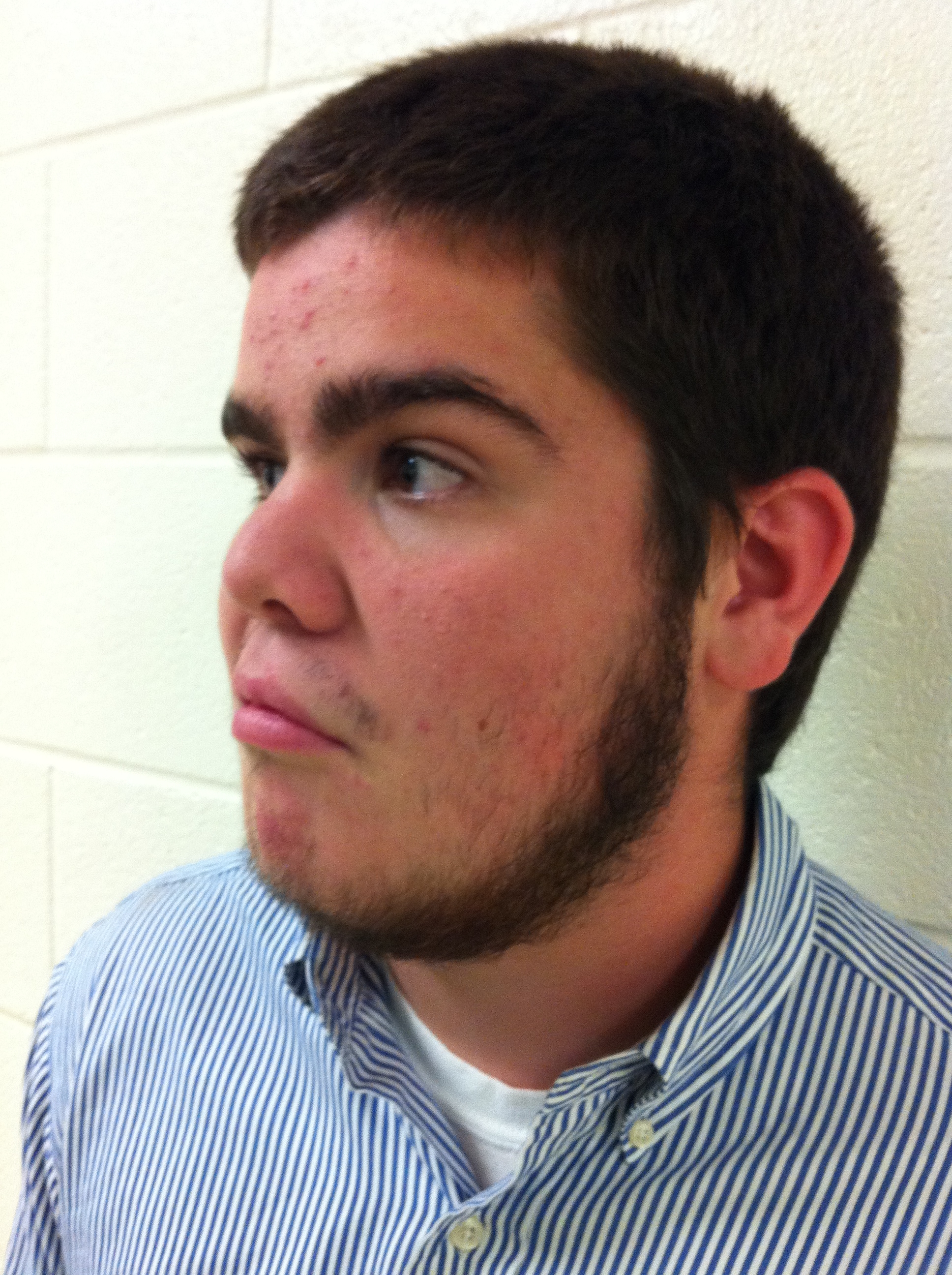 Facial hair grows on Leesville