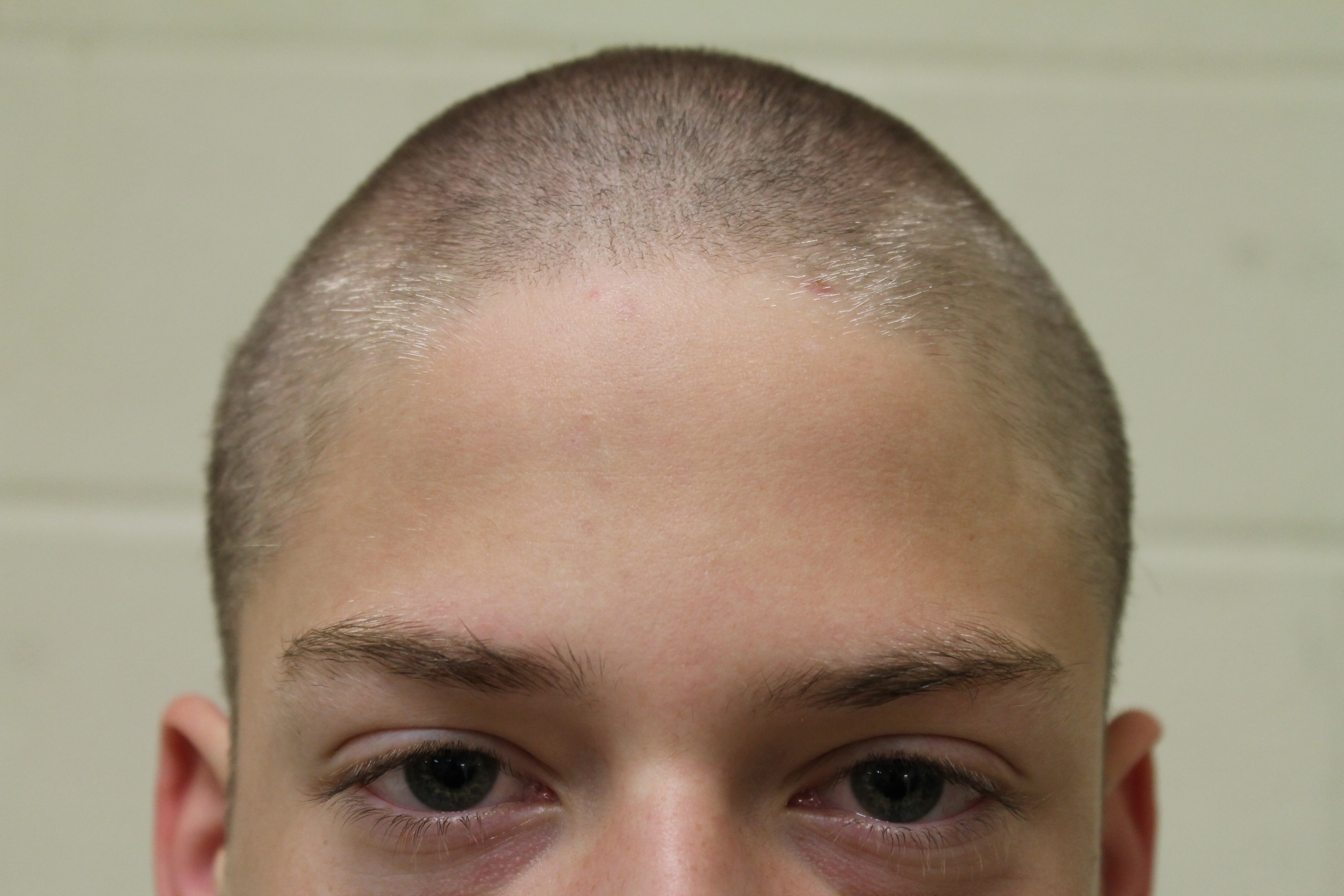 St. Baldrick’s fights cancer with a razor