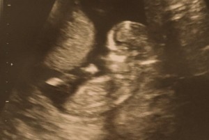 Mrs. Cade is Expecting!