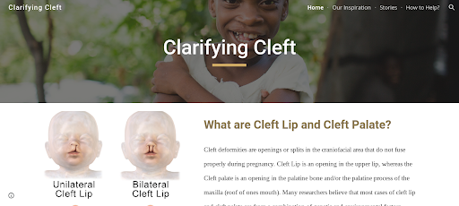 Clarifying Cleft